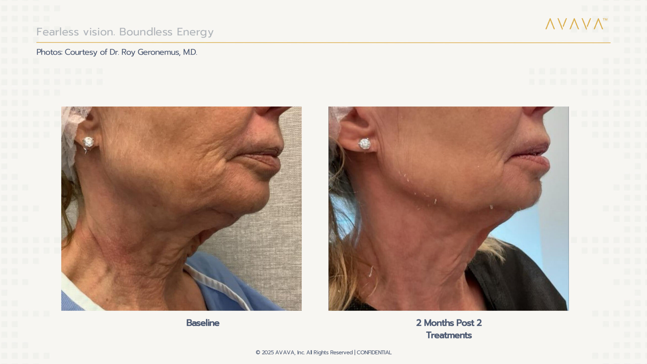 Before & After Assets from AVAVA site_page-0004